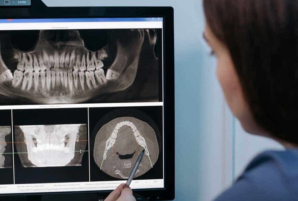 Scaling and Root Planing – Vallejo Family Dentistry