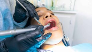 Dentist using high-speed tools during a dental bridge procedure