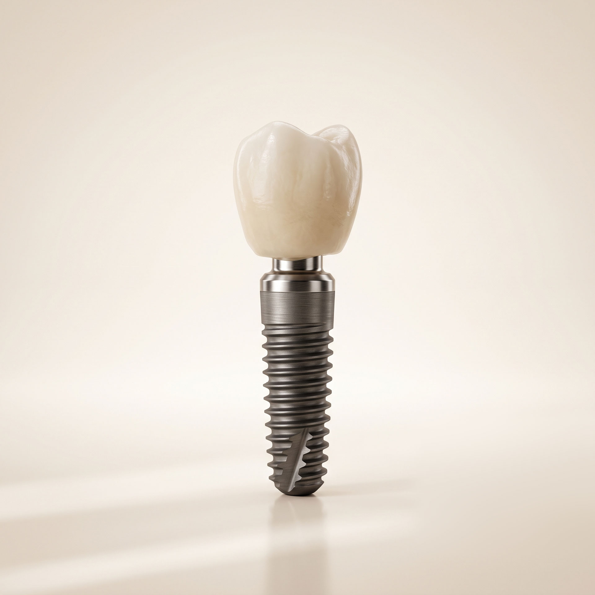 Diagram of the three components of a dental implant: titanium post, abutment, and crown